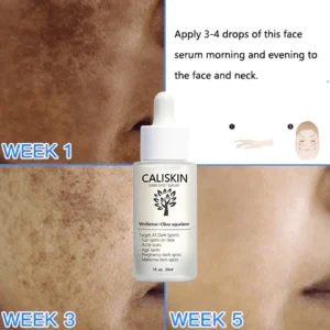 CALISKIN™ Dark Spot And Acne Treatment Serum Serum