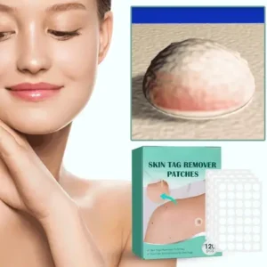 ClearDerm Skin Tag Removal Patch