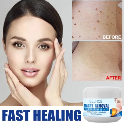 Clearasil™ Petechiae Removal Cream