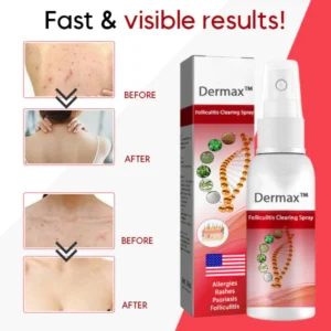 Dermax™ Folliculitis Clearing Spray