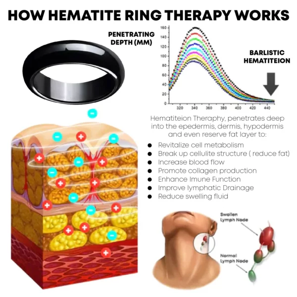 ELEA MagTherapeutic Hematite Ring