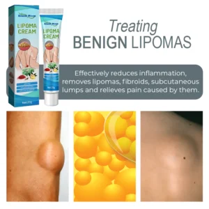 LUMPFree Herbal LipomaRemoval Cream