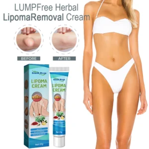 LUMPFree Herbal LipomaRemoval Cream