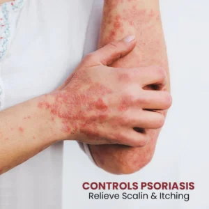 Medipure Psoriasis Relief Spray