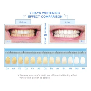 Purtimi™ Teeth Whitening Pen