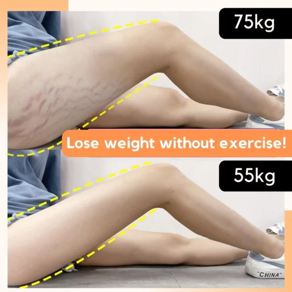 Reshape+ Leg Fat Burning Cream