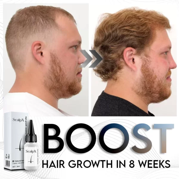 ScalpX Hair Growth Essence