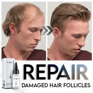 ScalpX Hair Growth Essence