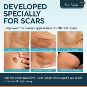 ScarAway® 100% Advanced Scar Gel