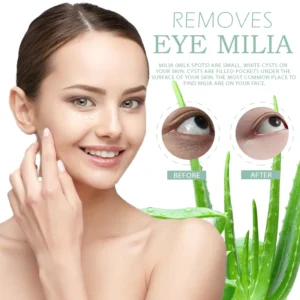 SkinFIX EyeMilia Removal HerbalCream