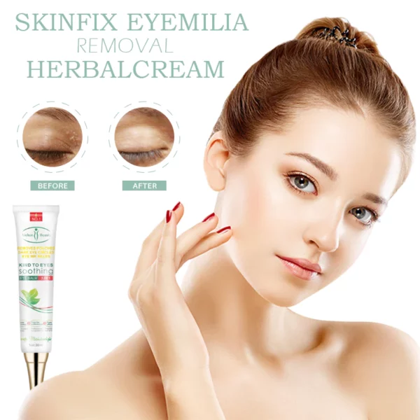 SkinFIX EyeMilia Removal HerbalCream