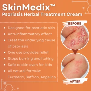 SkinMedix™ Psoriasis Herbal Treatment Cream