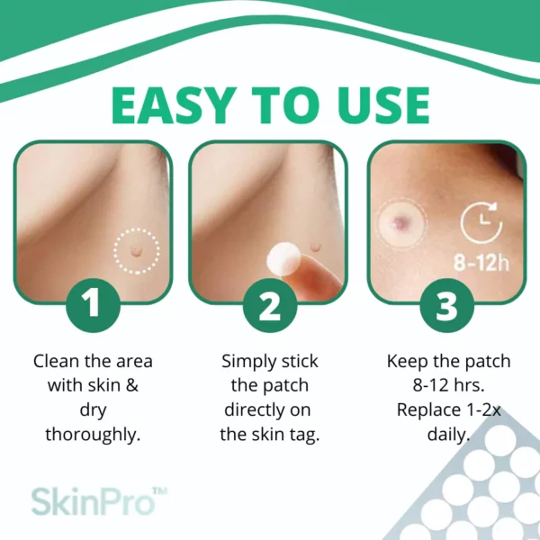 SkinPro™ Skin Tag Remover Patch