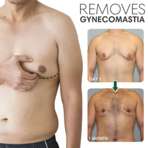 SoliPac™ Gynecomastia Tightening Ginger Cream