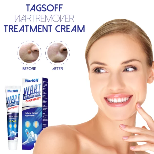 TagsOff WartRemover TreatmentCream