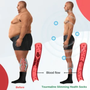 Akupunktur Slimming Socks