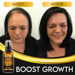 BioPRO Hair Growth Boosting Spray