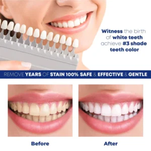 BrightSmile TeethWhitening Essence Pen