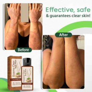 CalmSkin™ Eczema Clear Body Wash