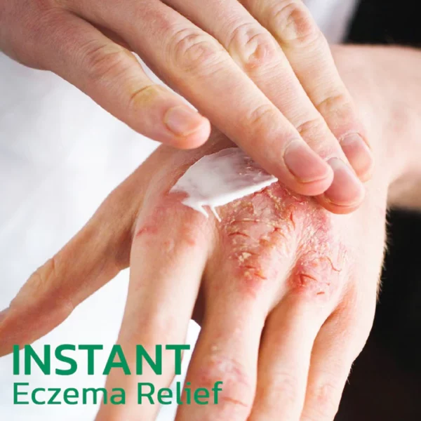 EczemaTherapy Herbal Hydration Cream