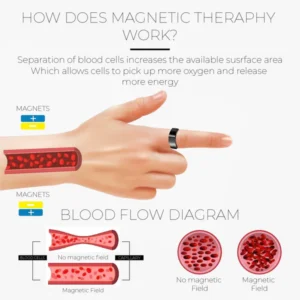 LymphDrainage SlimFit MagneticTherapy Ring