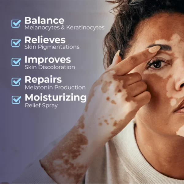 MEDix™ Vitiligo Relief Spray