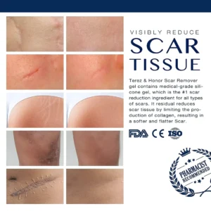 Medical Grade Silicone Scar Gel