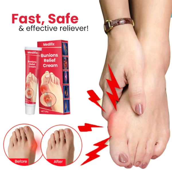 Medifix Bunions Relief Cream