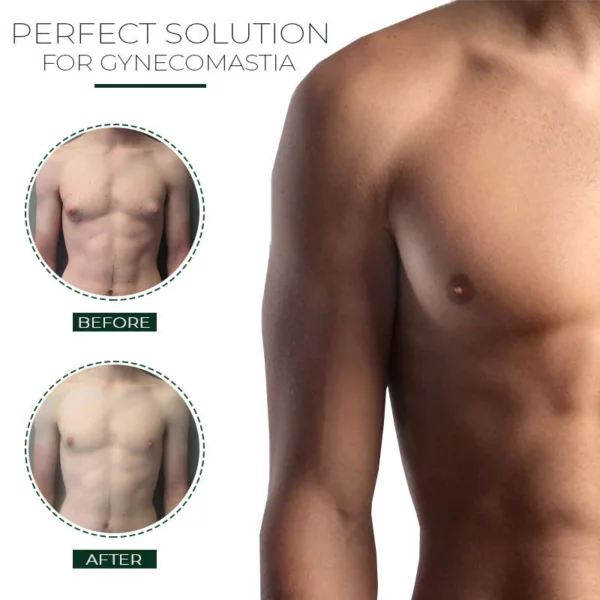 MensGynecomastia ReductionHerbal Ointment