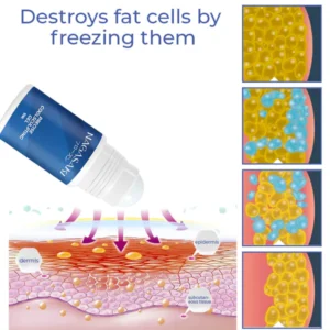 Nagasaki DermoFreeze™ Precise CoolSculpting Gel