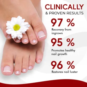 NailCare™ Ingrown Relief Oil