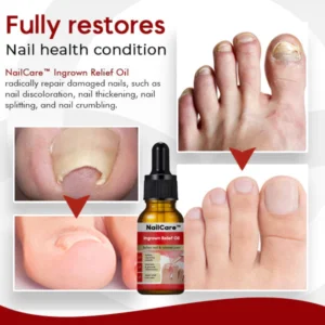 NailCare™ Ingrown Relief Oil