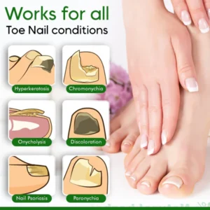 NailCare™ Toe Nail Treatment Gel