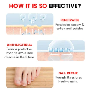 Nailcare™ Ingrown Toe Nail Drops