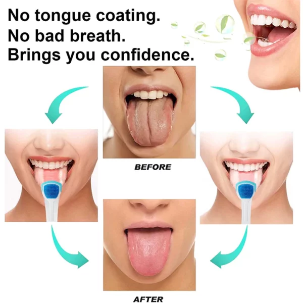 Oral Hygiene Brush & Tongue Cleansing Gel