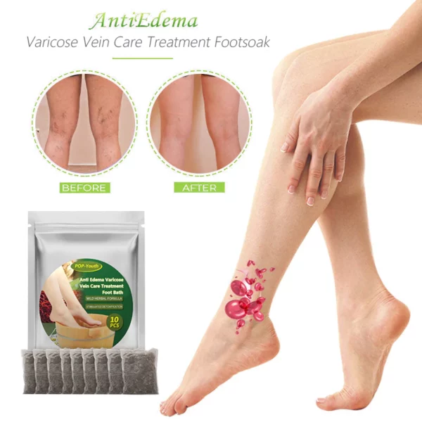 POP-Youth™ Anti-Edema VaricoseVeinCare TreatmentFootSoak