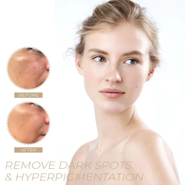 POP-Youth™ Spot-OFF DarkSpot Removal Serum