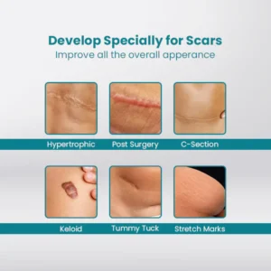 ScarOFF™ Advanced Scar Removal Gel