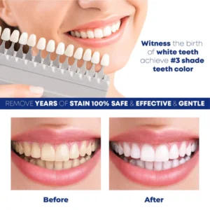 ShinySmile TeethWhitening Essence Pen