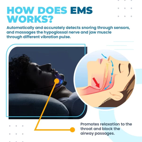 SleepPro™ EMS Anti-Snoring Device