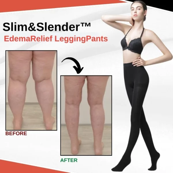 Slim&Slender™ EdemaRelief LeggingPants