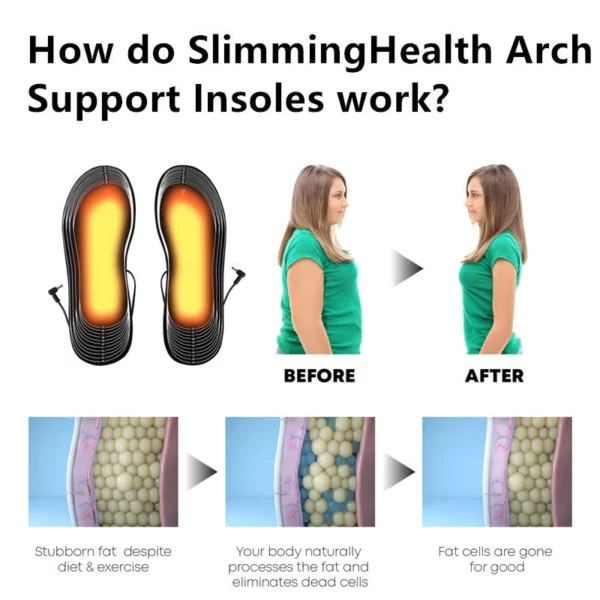 SlimmingHealth Arch Support Insoles