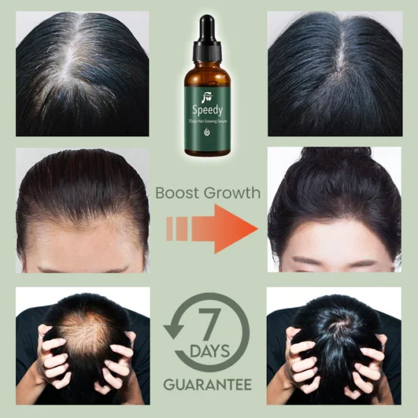 Speedy 7Days Hair Growing Serum