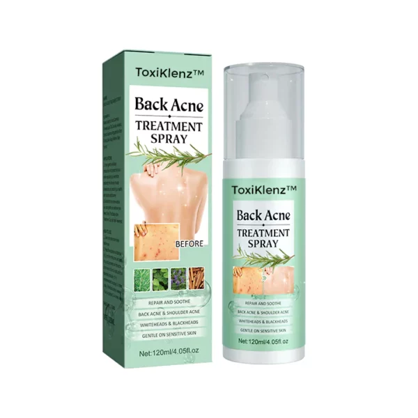 ToxiKlenz™ Back Acne Treatment Spray