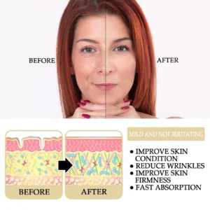 Youthful™ Facial Rapid Wrinkle Reduction Skin Repair&Renewal Serum