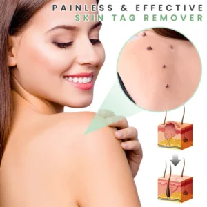 AMORIE Peau SKINTAG'Gone Patch