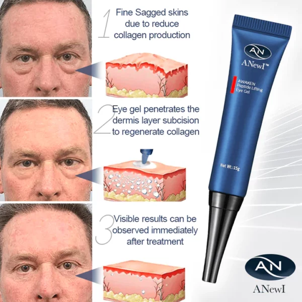 ANewI™ Pro Eye-Lift Depuffing Gel