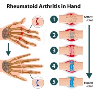 Advanced™ Joint & Bone Therapy Gel