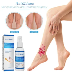 AntiEdema VaricoseVeinCare TreatmentSpray