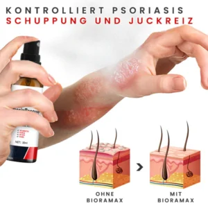 BIORAMAX PsoriaRescue Behandlung Spray